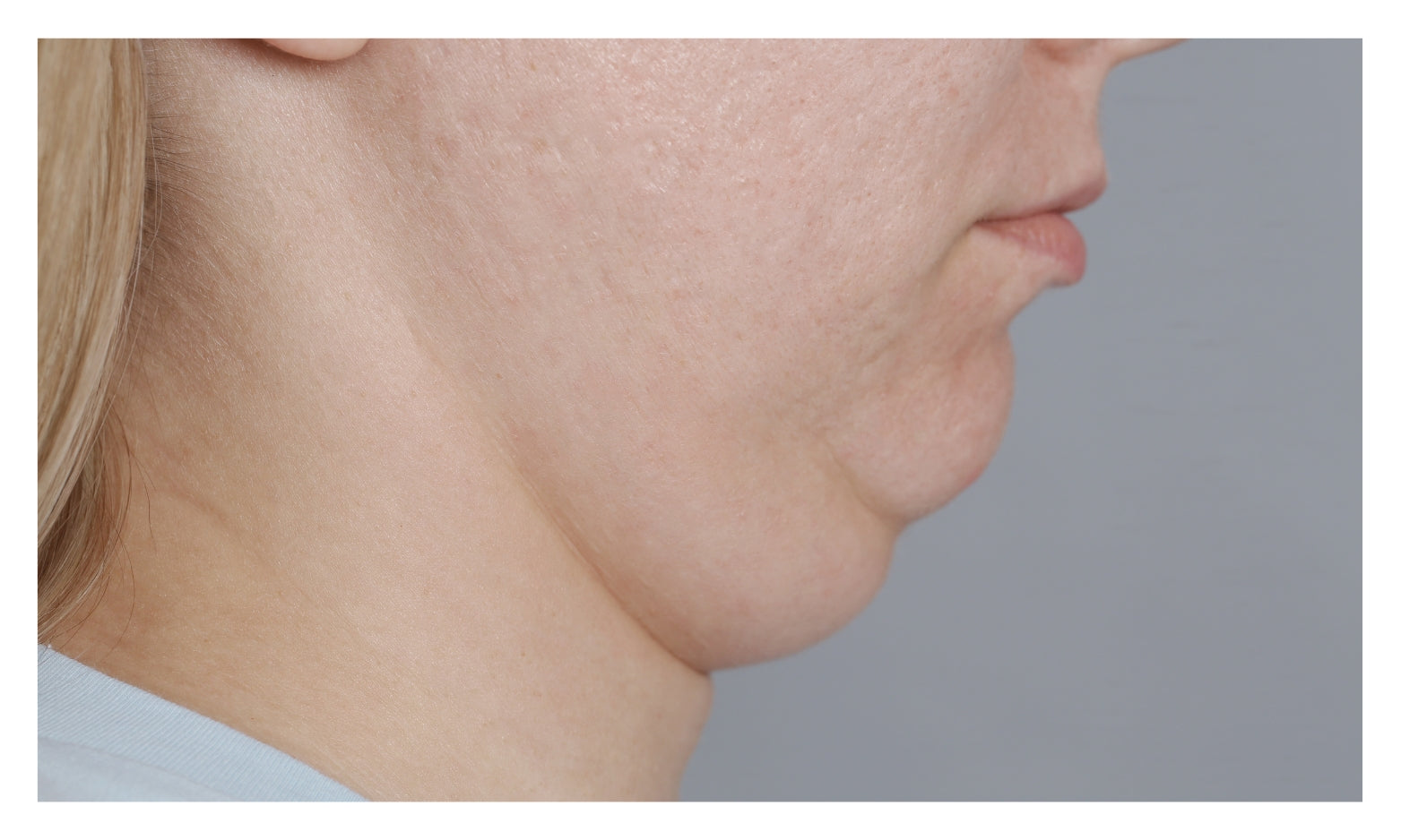 Chicago Cosmetic Surgery & Dermatology