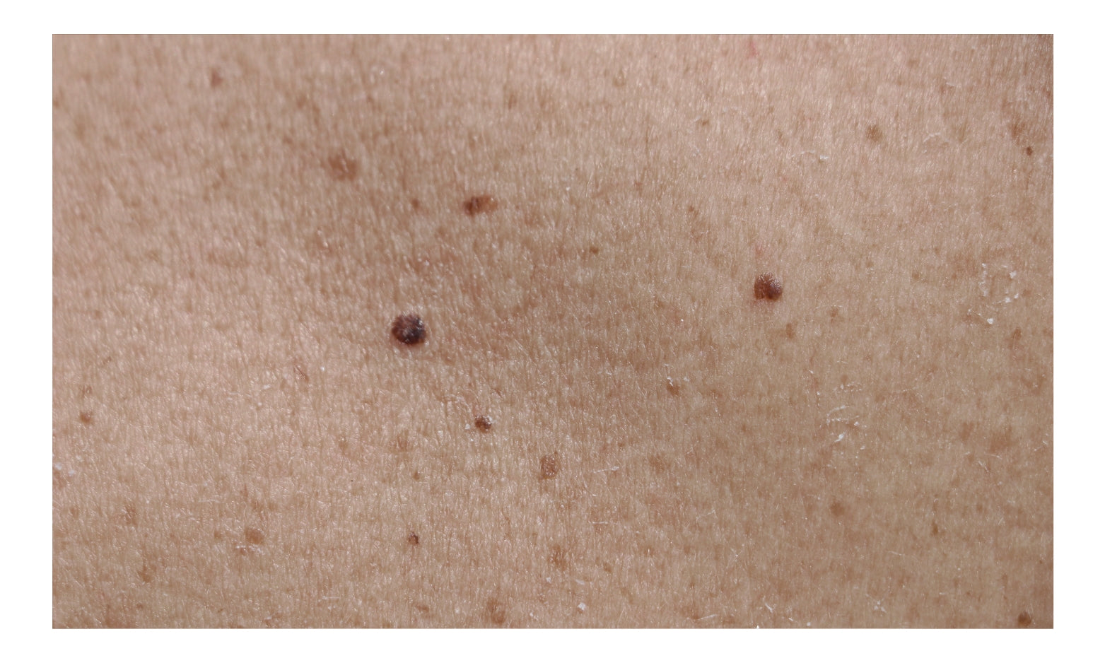 Chicago Cosmetic Surgery & Dermatology