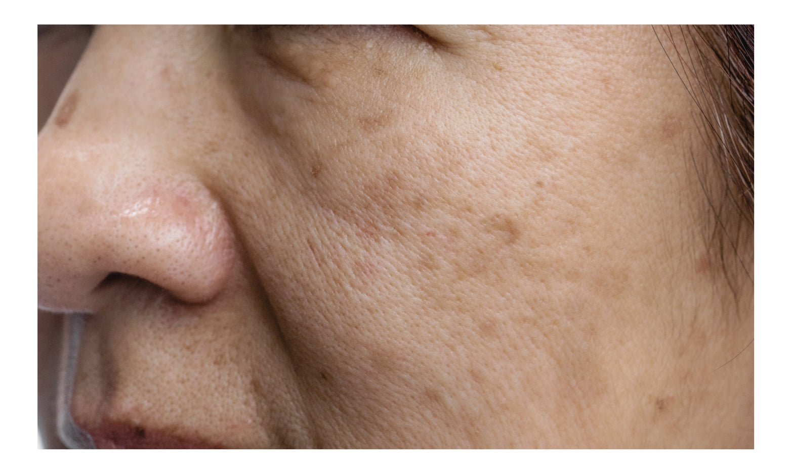 Chicago Cosmetic Surgery & Dermatology