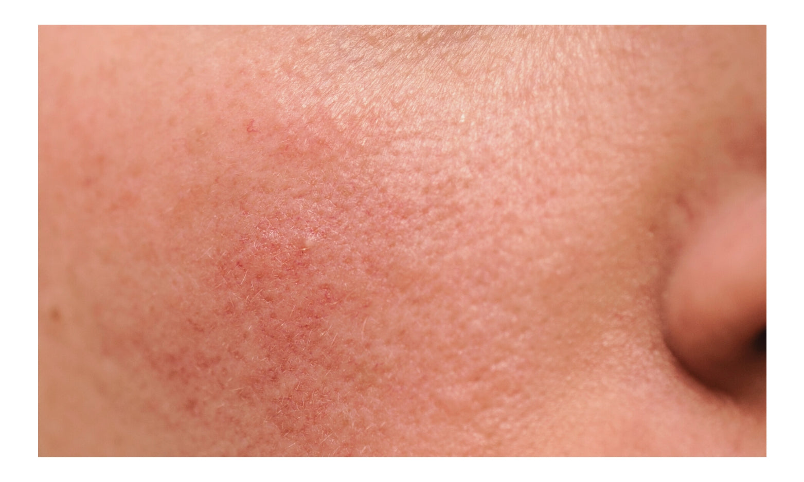 Chicago Cosmetic Surgery & Dermatology
