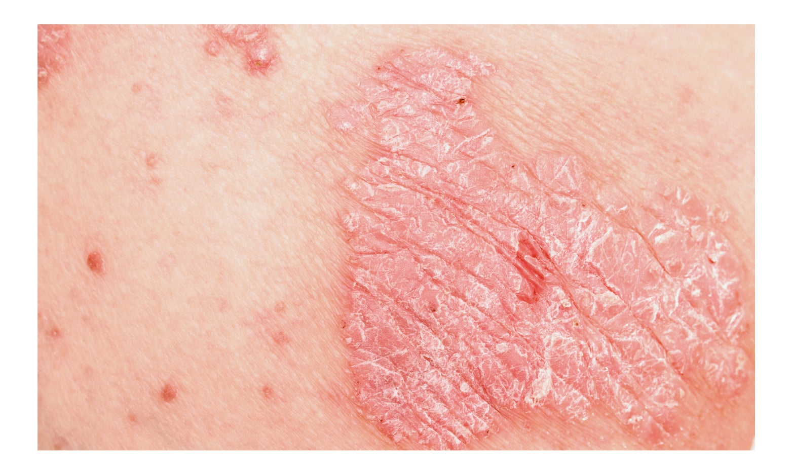 Chicago Cosmetic Surgery & Dermatology