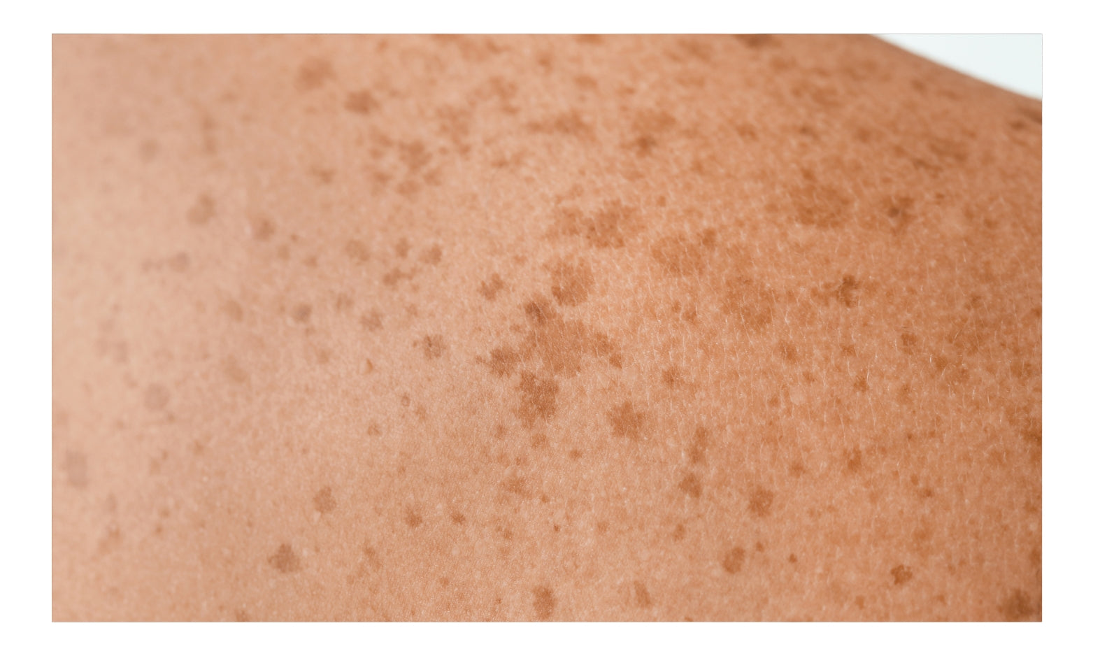 Chicago Cosmetic Surgery & Dermatology