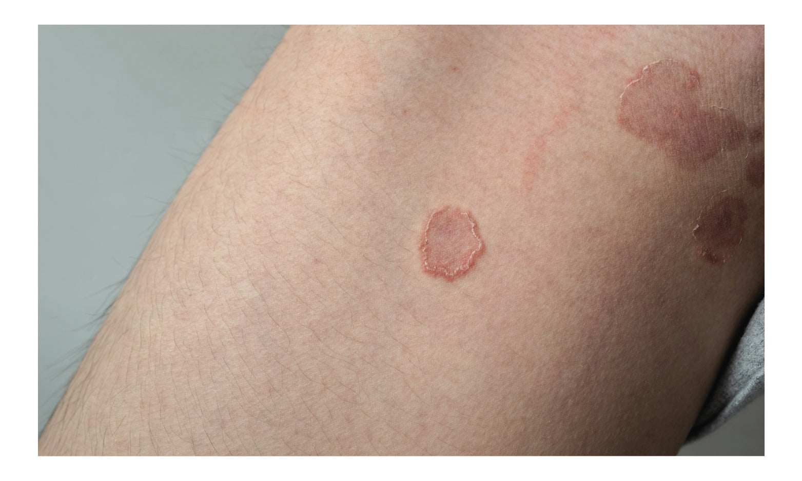 Chicago Cosmetic Surgery & Dermatology