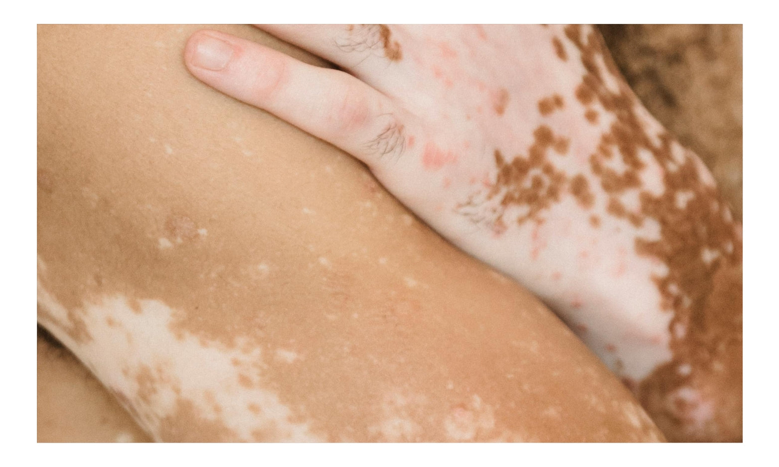 Chicago Cosmetic Surgery & Dermatology