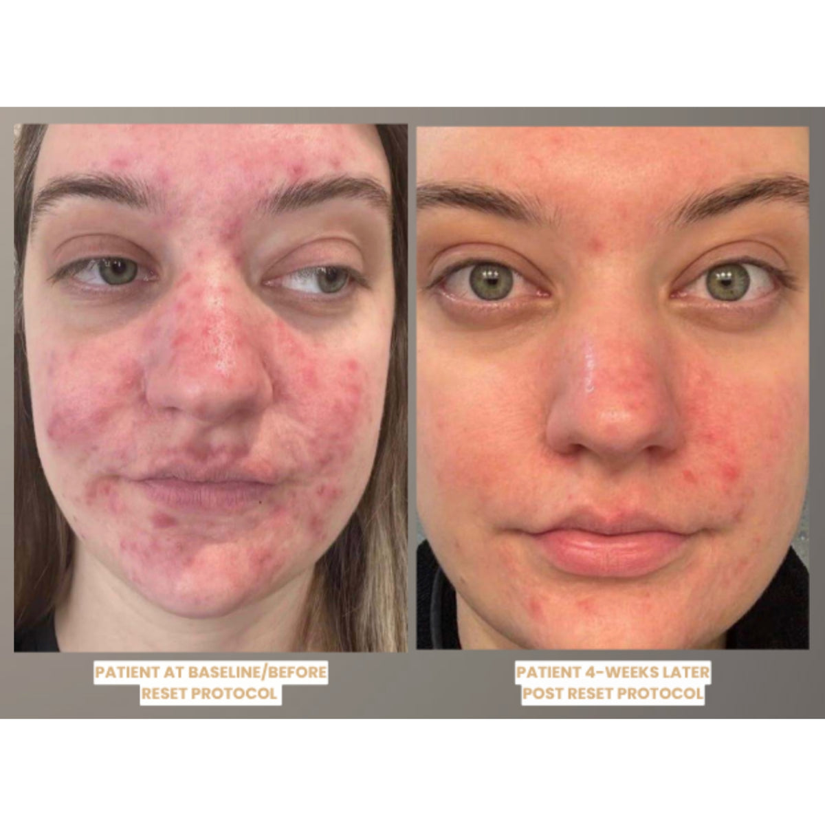 $25 Off NEW CO2Lift® R4 Renewal Facial & Hand Renew Treatment