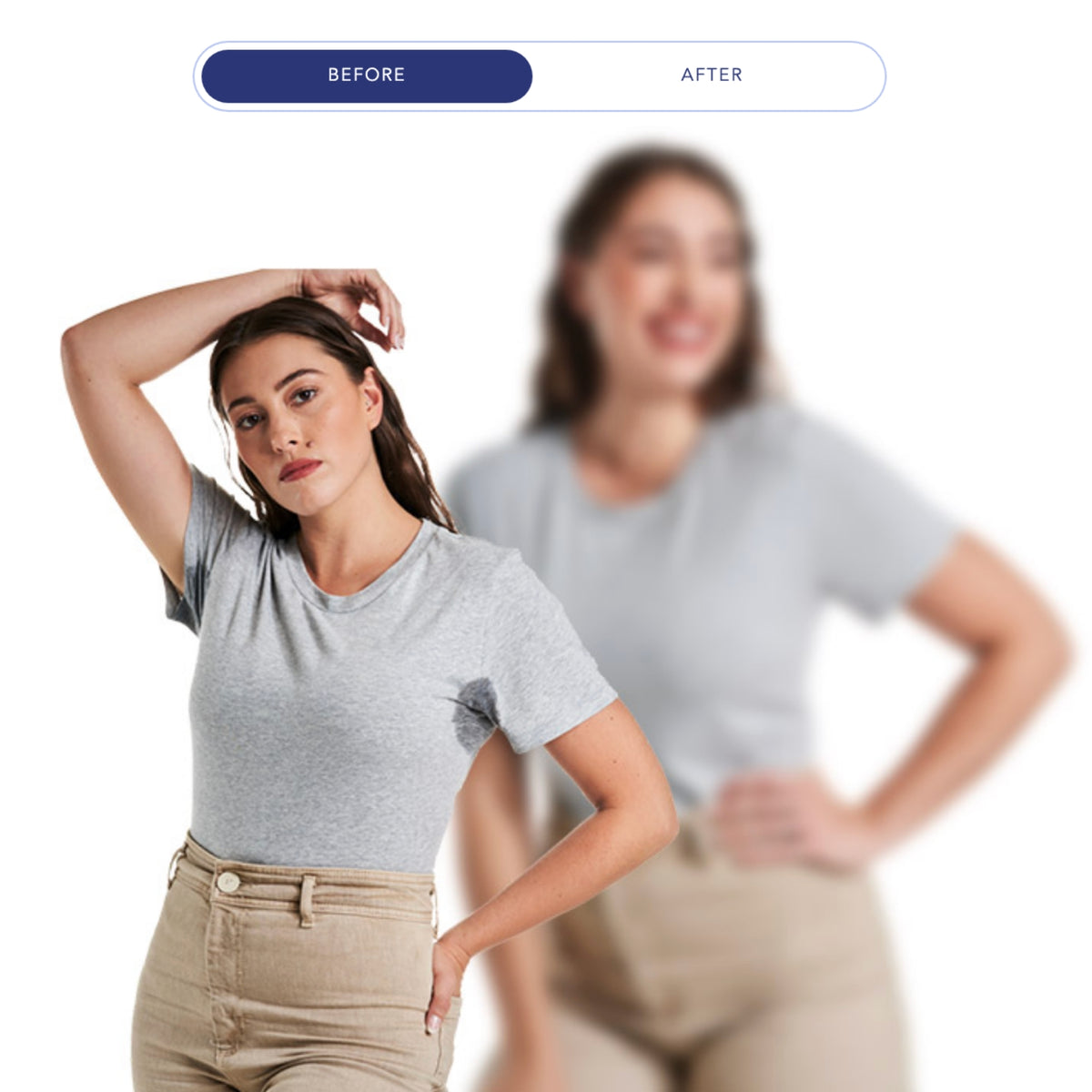 $400 Off miraDry® – Package of (2)*