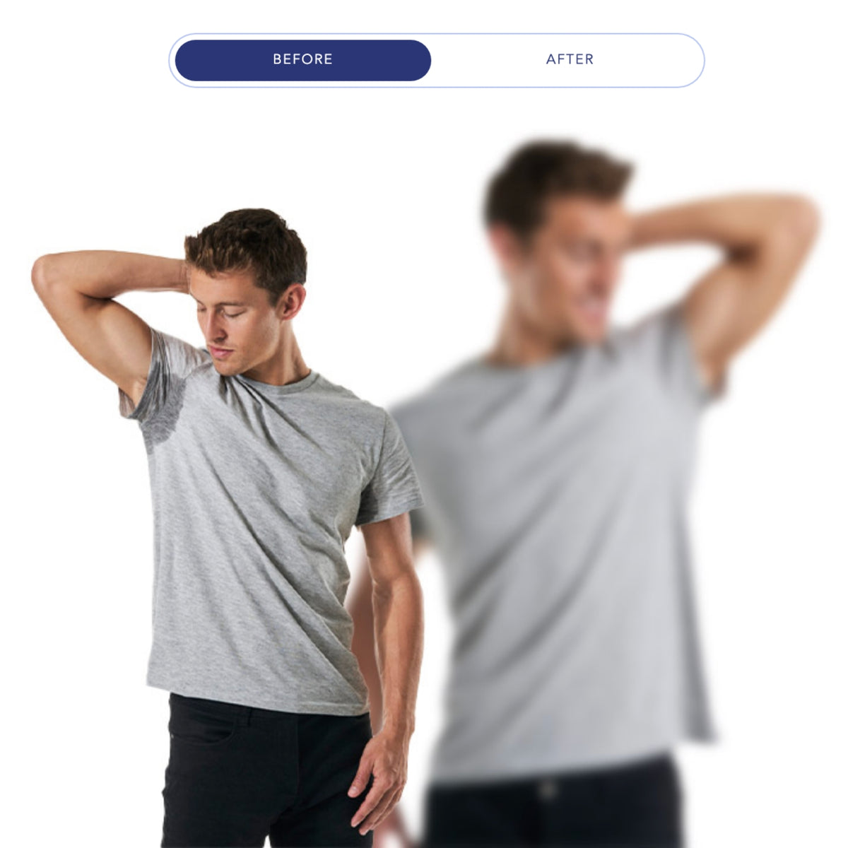 $400 Off miraDry® – Package of (2)*