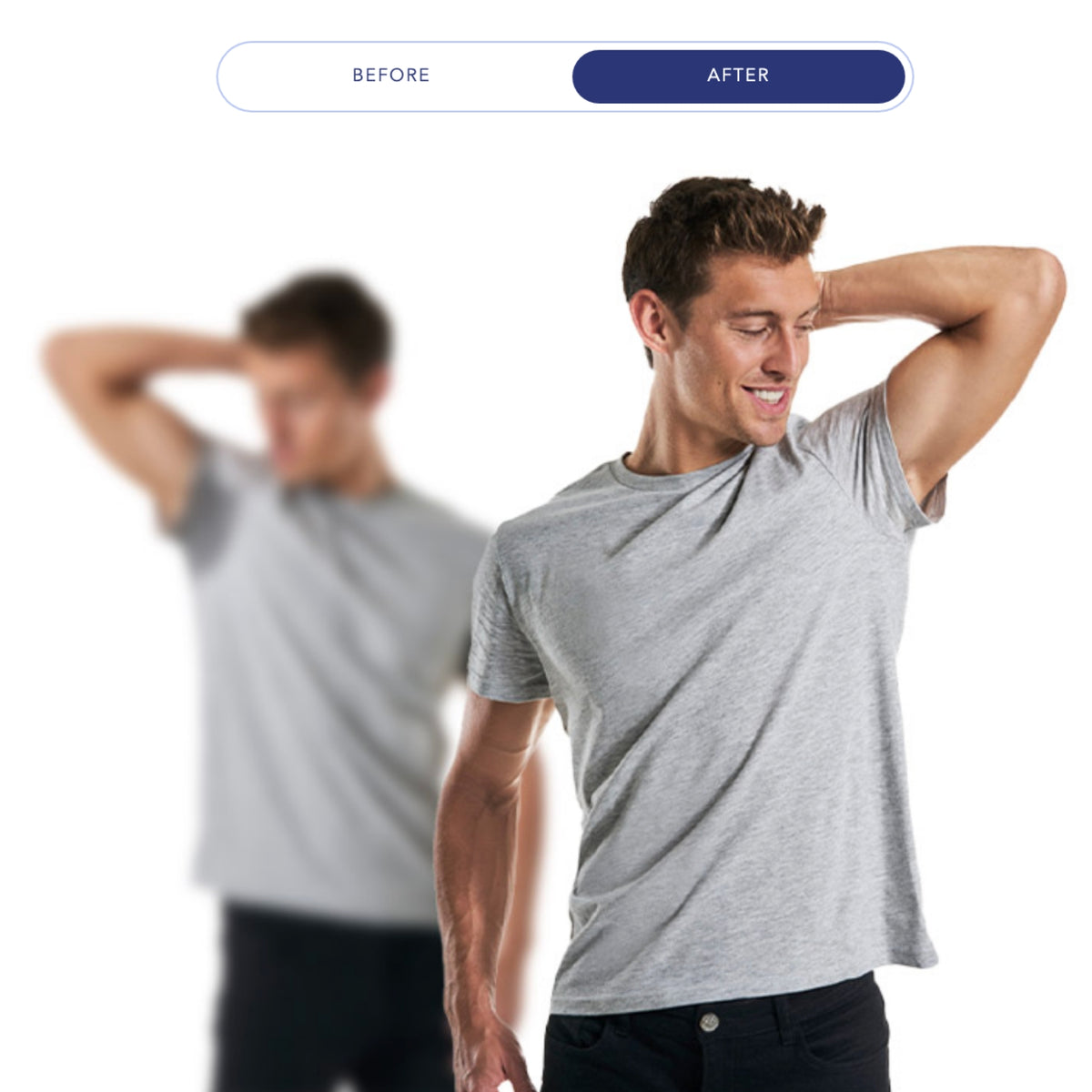 $400 Off miraDry® – Package of (2)*