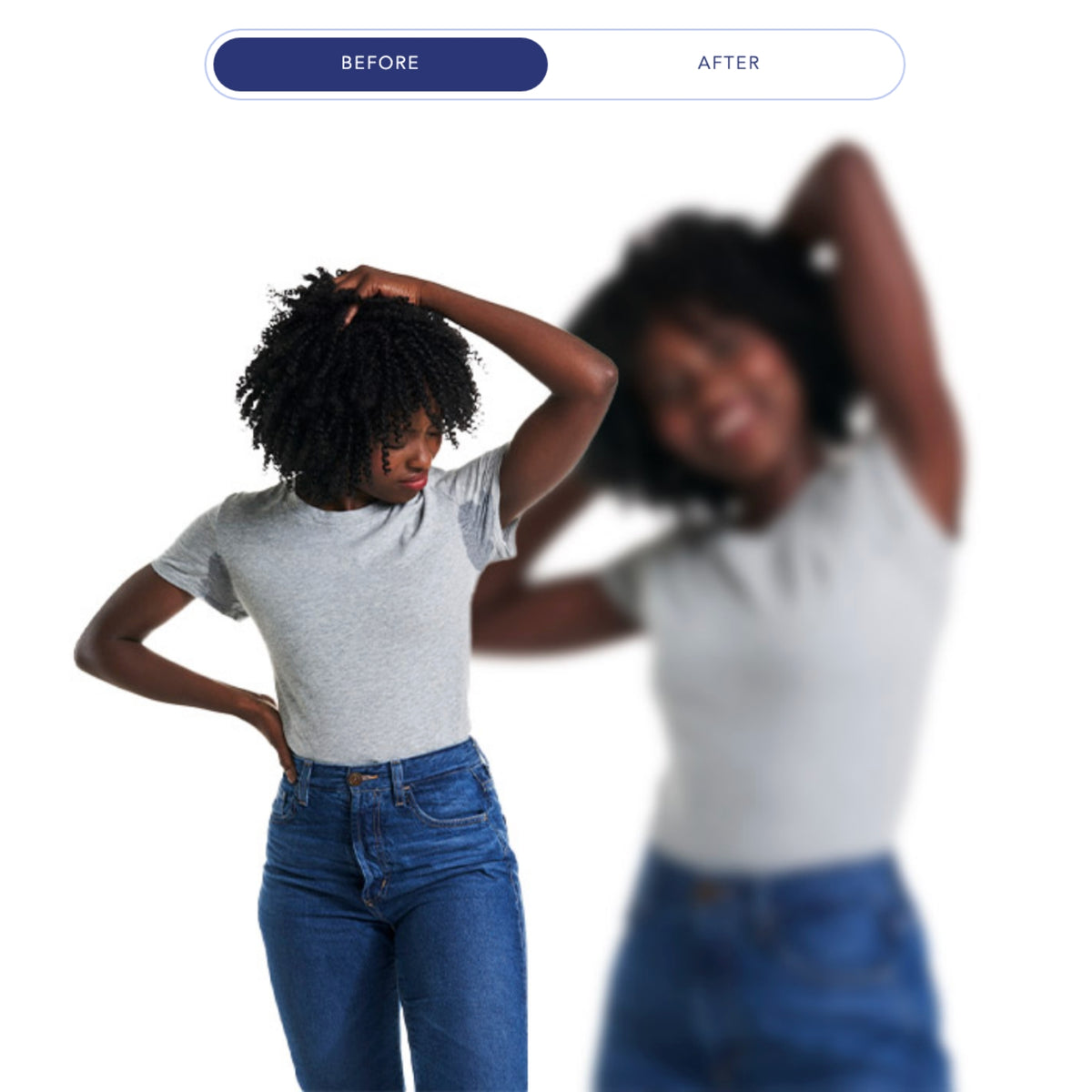 $400 Off miraDry® – Package of (2)*
