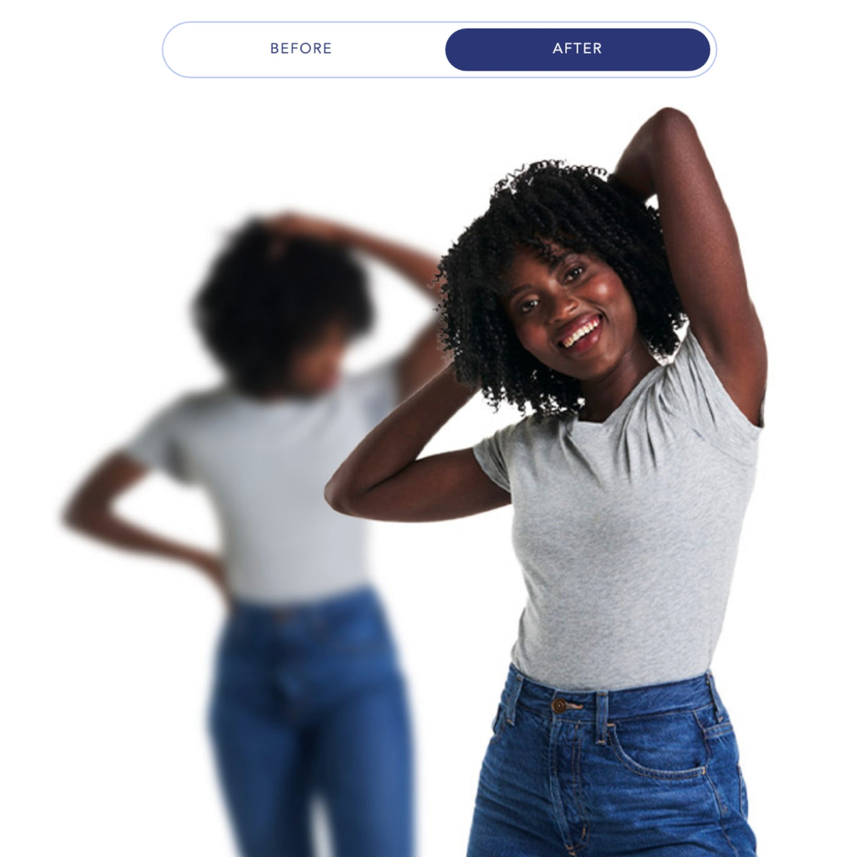 $400 Off miraDry® – Package of (2)*