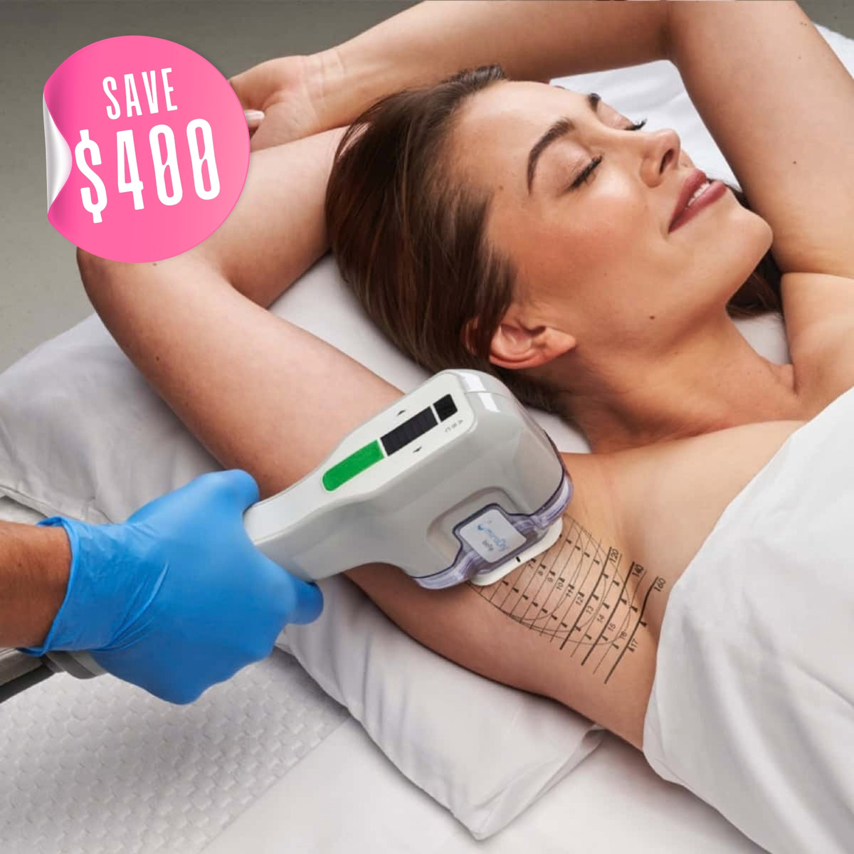 $400 Off miraDry® – Package of (2)*