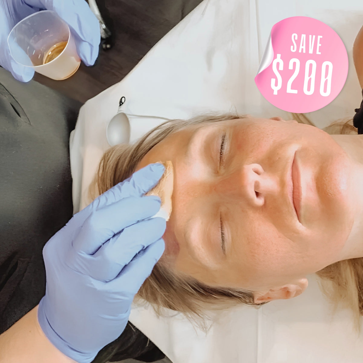 $200 Off VI Peel® – Face and Neck, Package of (3)