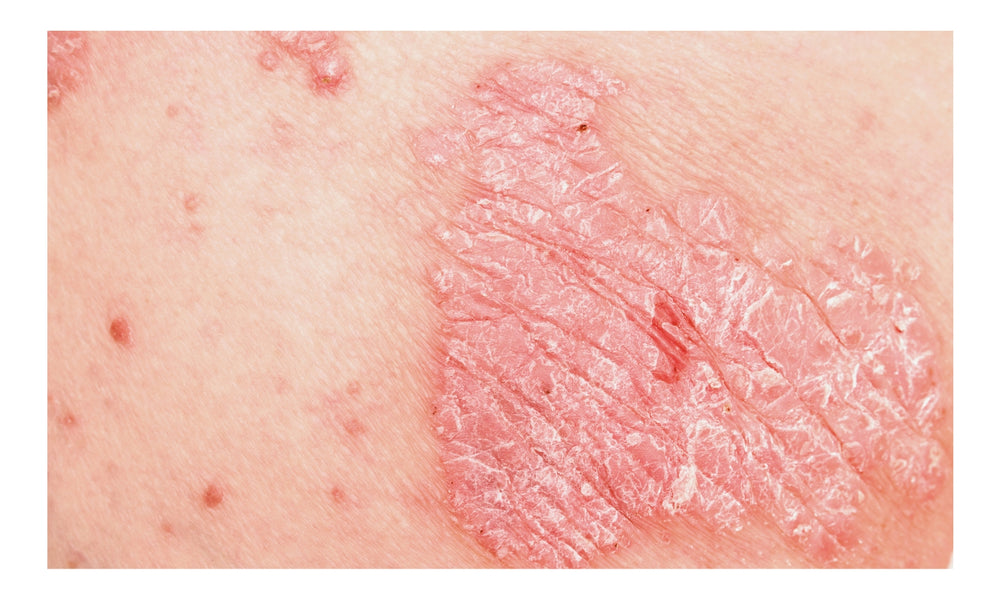 Skin Conditions – Chicago Cosmetic Surgery & Dermatology